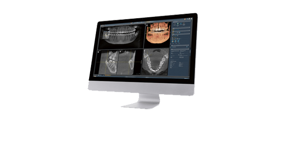 3d tech button sirona
