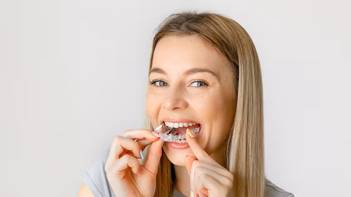 Clear braces patient inserting tray